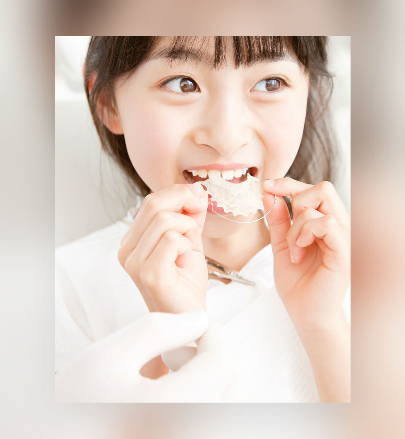 小児矯正