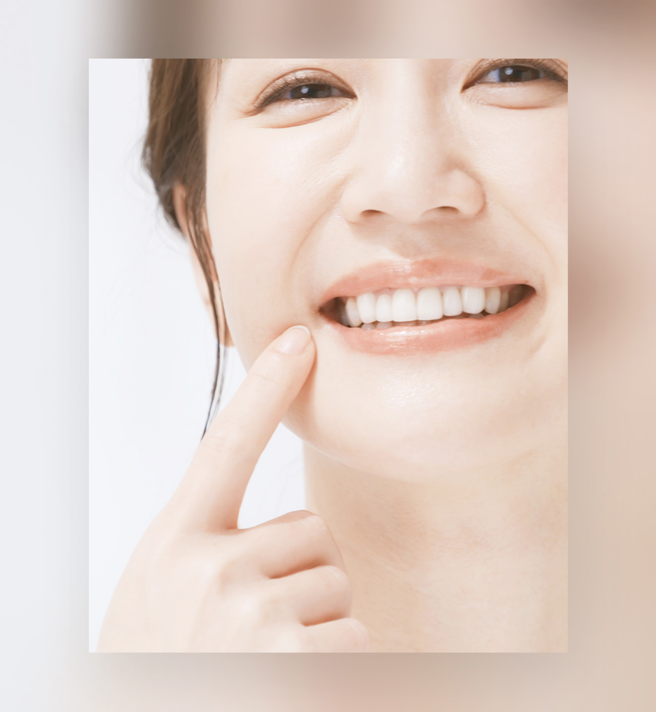 医療ホワイトニング